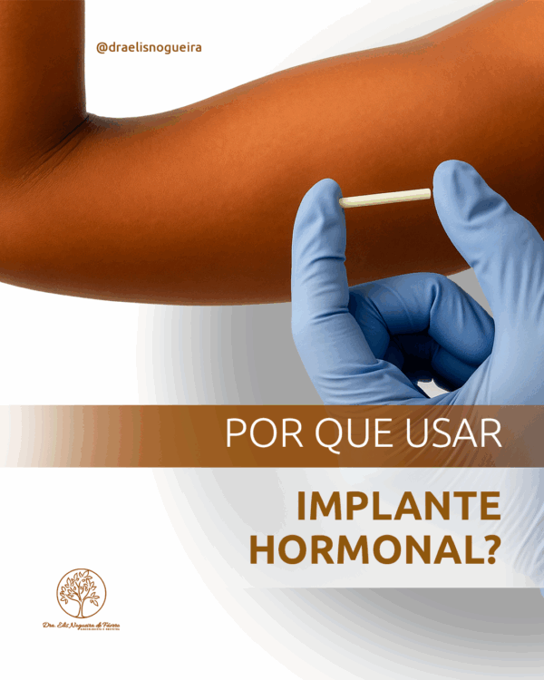 por-que-usar-implante-hormonal-dra-elis-nogueira