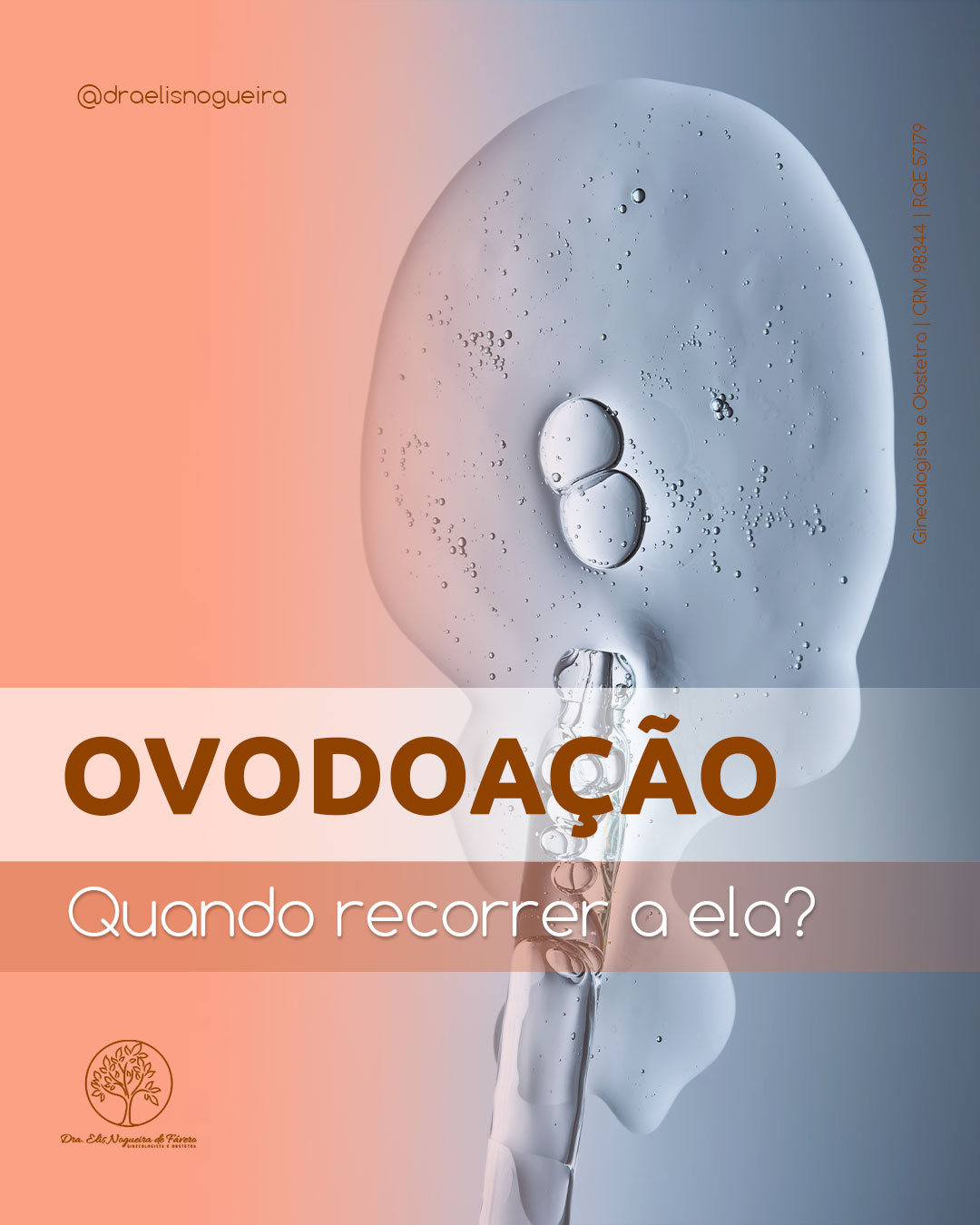 Ovodoação: Quando recorrer a ela?
