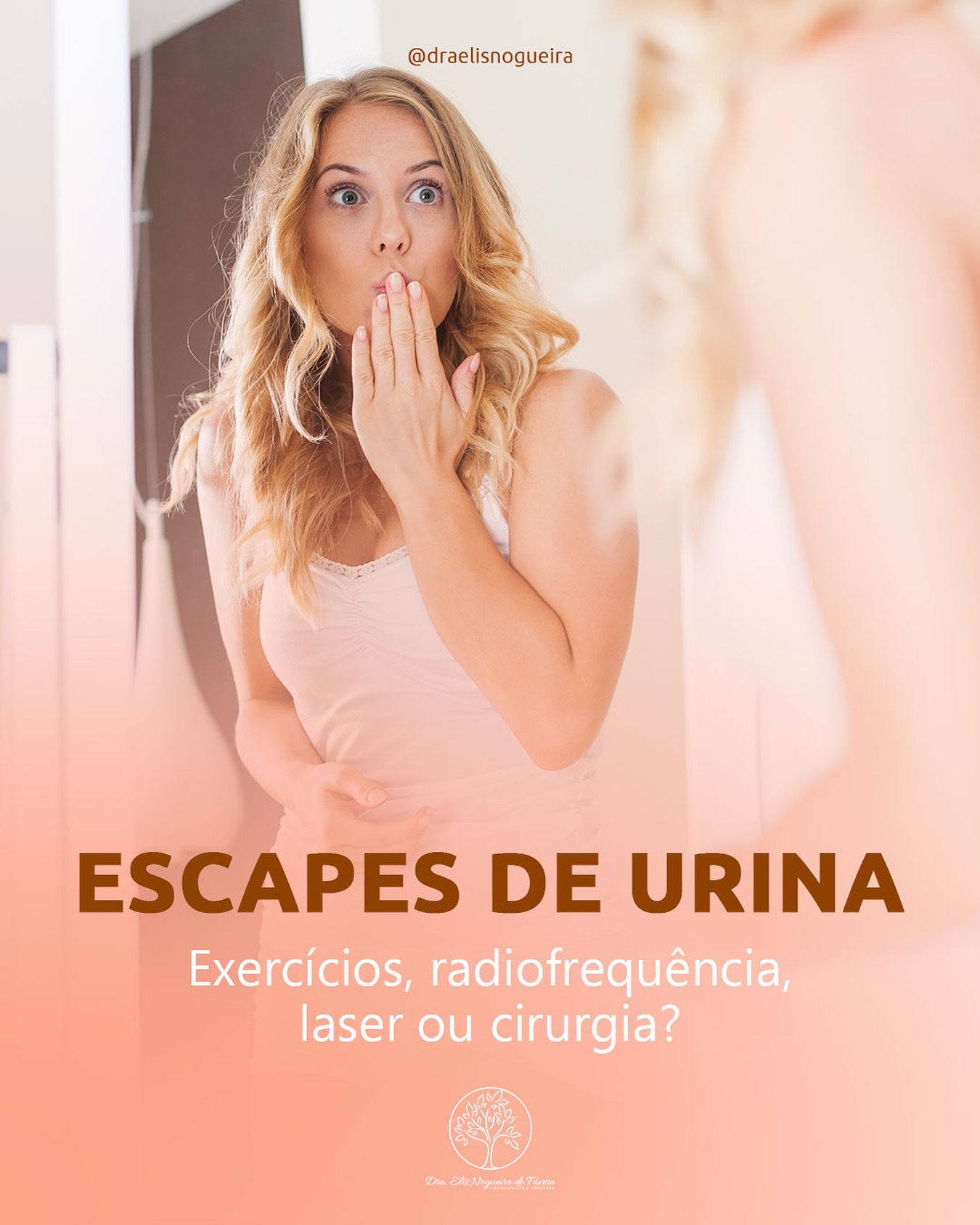 Escapes de Urina: exercícios, radiofrequência, laser ou cirurgia?