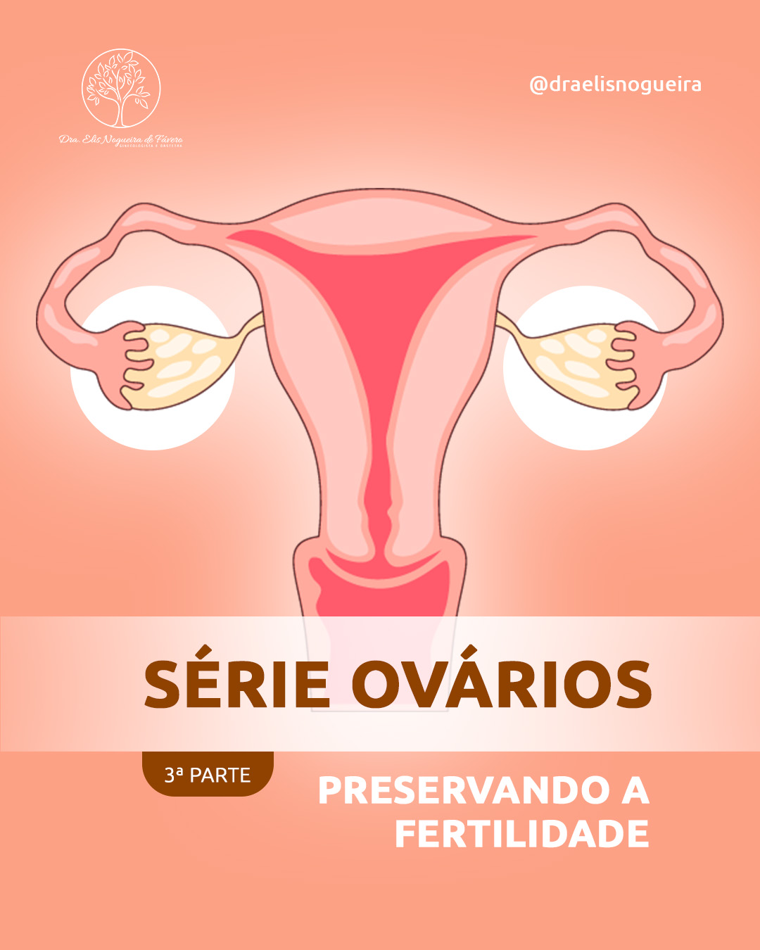 Série Ovários | Parte 3 - Preservando a fertilidade - Dra. Elis Nogueira