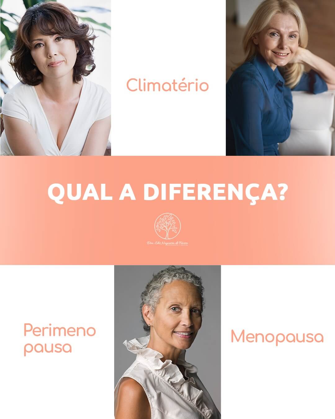 Climatério, Perimenopausa e Menopausa: qual a diferença?